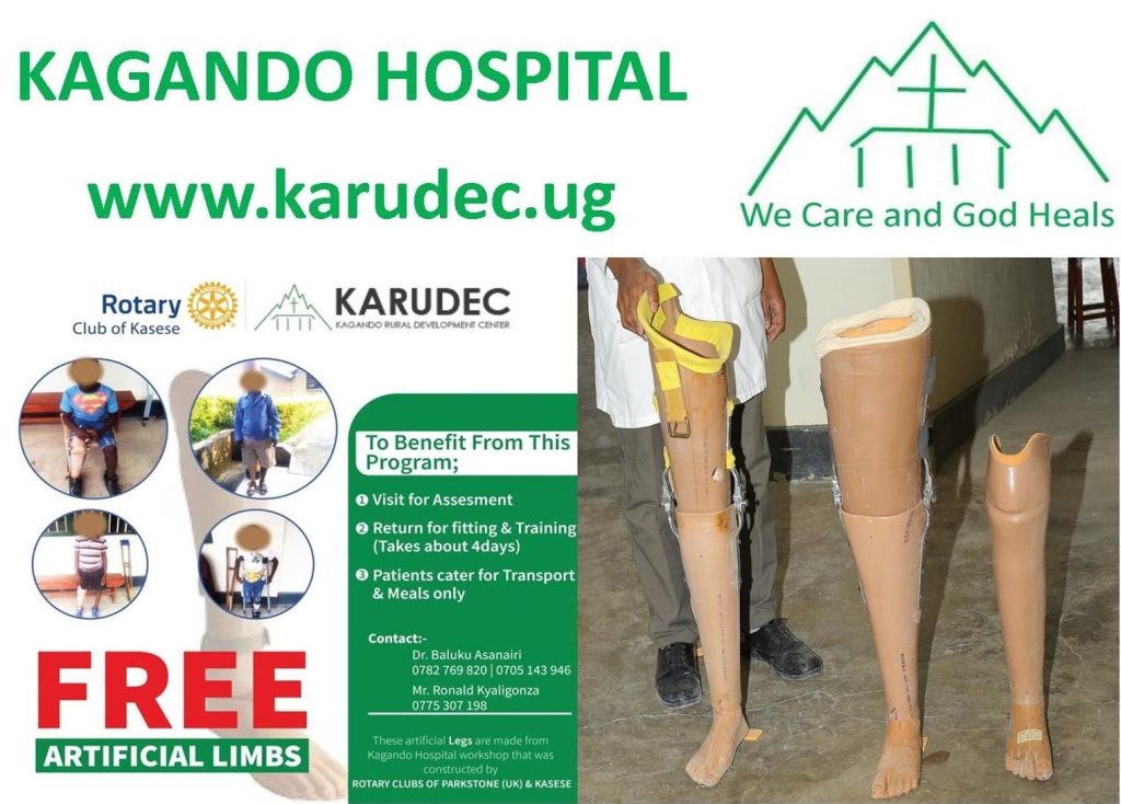 FREE ARTIFICIAL LIMBS AT KAGANDO HOSPITAL  REHABILITATION DEPARTMENT